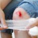 How to Speed Up the Wound Healing Process
